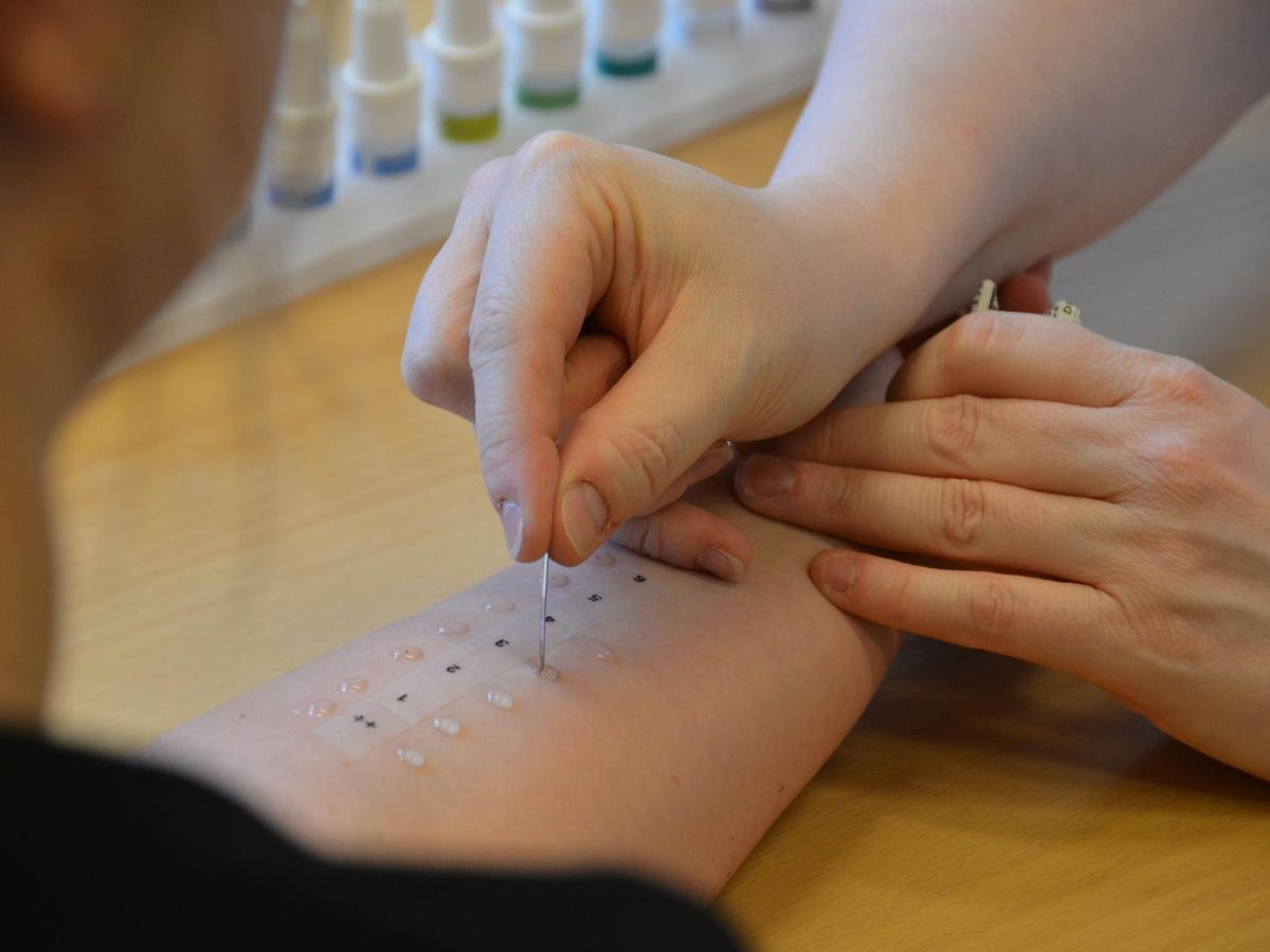 Jak przebiega diagnoza alergii i jakie badania warto wykonać?